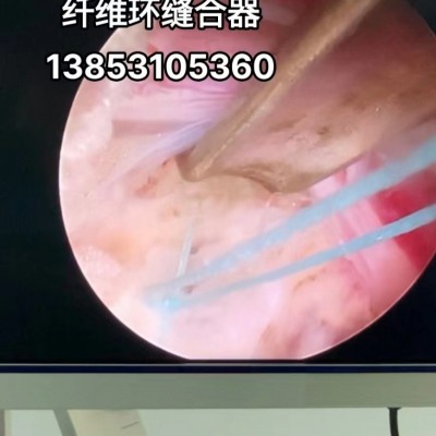 纤维环缝合器