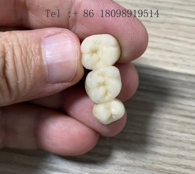 深圳假牙厂家 义齿牙齿矫正器牙套烤瓷牙美国FDA