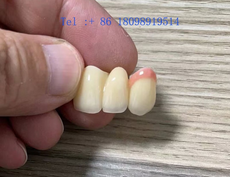 香港义齿公司 生产隐形义齿 固定义齿牙套发货全球